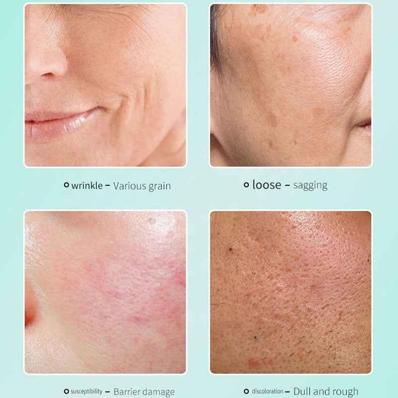 9-Piece Travel Skincare Set – Anti-Aging & Moisturizing Kit